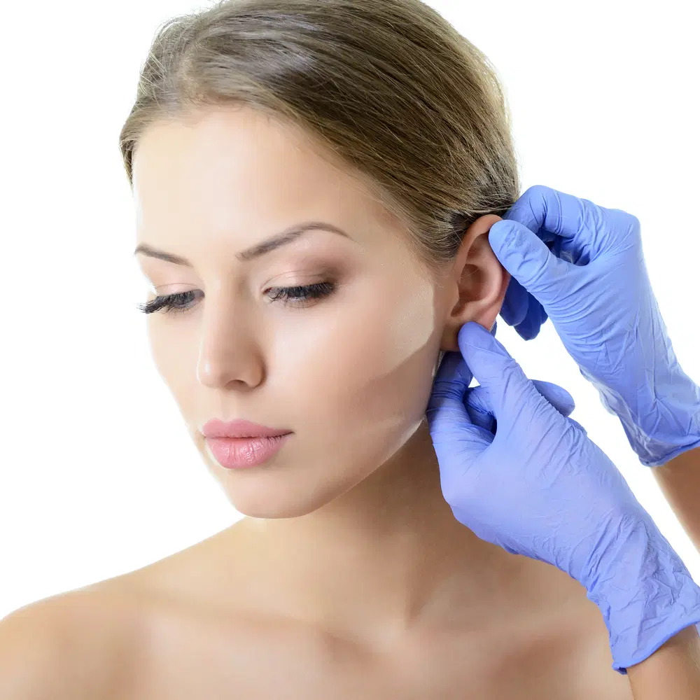 OTOPLASTIA — Rogério Morale