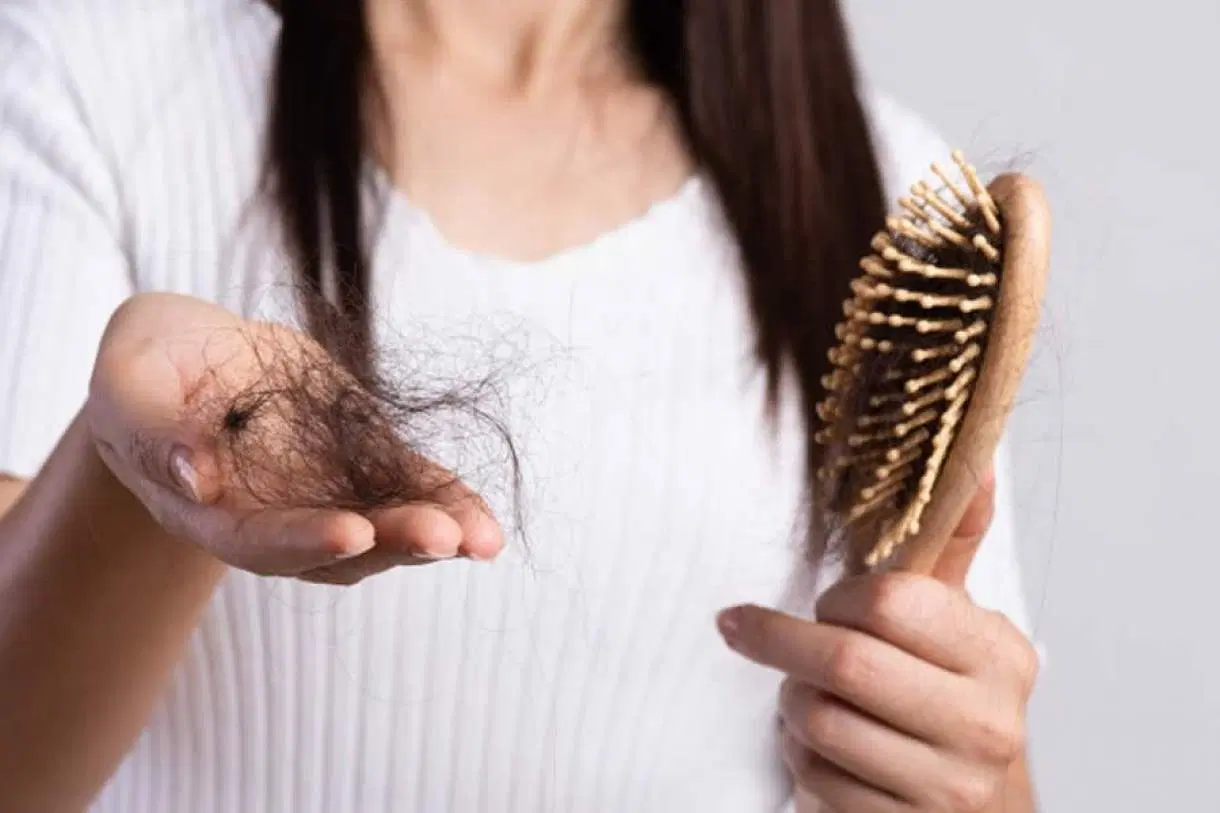 Queda de cabelo após a cirurgia bariátrica é normal? Por que acontece?