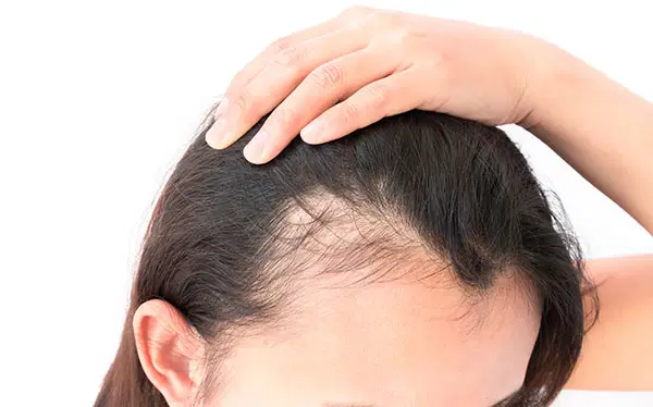 Dermatologia capilar ou tricologia