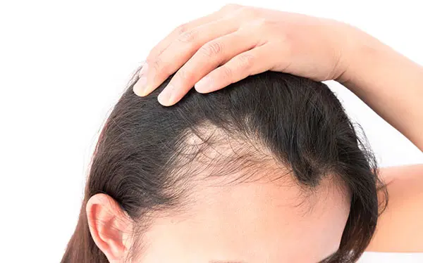 Dermatologia capilar ou tricologia