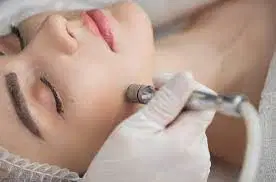 Peeling