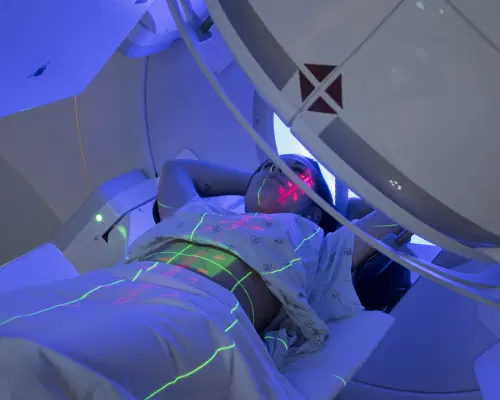 O que é e como funciona a radioterapia?