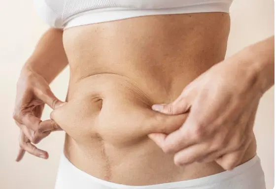 Cirurgia plástica após perda de peso: o que considerar antes do procedimento