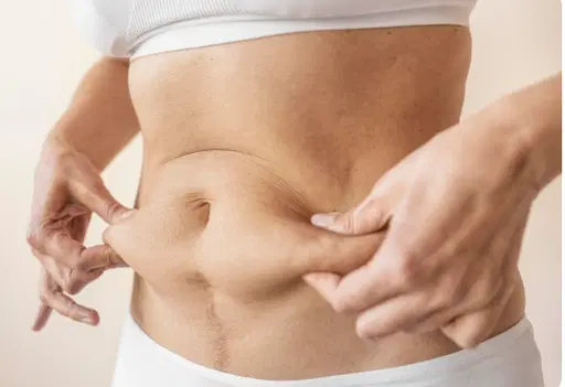 Cirurgia plástica após perda de peso: o que considerar antes do procedimento