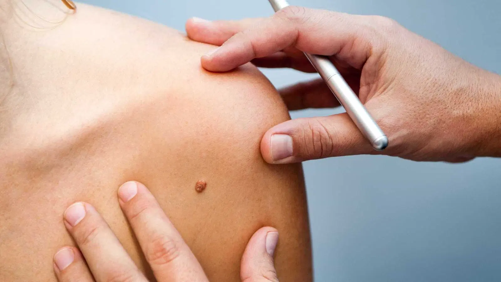 Dermatologia Cirúrgica