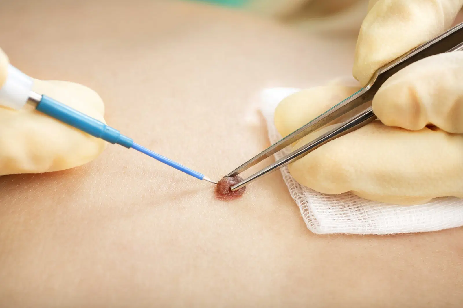 DERMATOLOGIA CIRÚRGICA