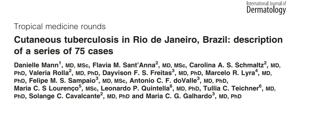 Dr. Felipe Soeiro publica mais um artigo na respeitada revista Internacional Journal of Dermatology