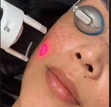 Cool Peel