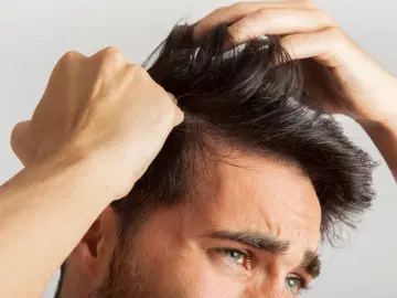 O que você precisa saber sobre caspa