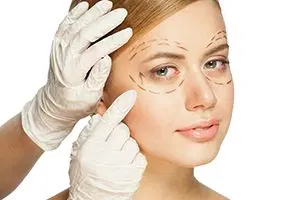 BLEFAROPLASTIA — Rogério Morale