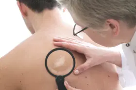 Janeiro é o mês de combate à hanseníase. O que você sabe sobre esta doença?