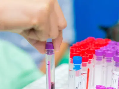O que são os triglicerídeos e qual a função deles?